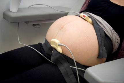 Monitoraggio cardiotografico su pancia di donna incinta