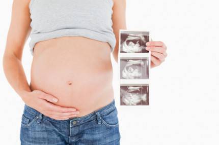 Donna incinta che mostra delle ecografie