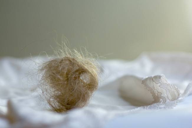 Mucchi di capelli persi durante il postpartum