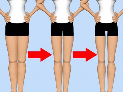 thigh-gap lo spazio tra le cosce