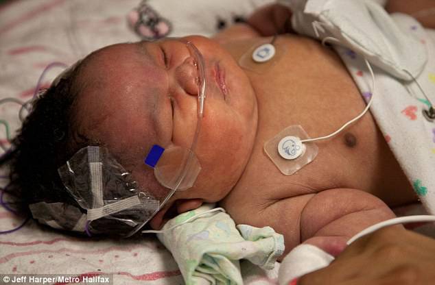 neonata miracolo in ospedale