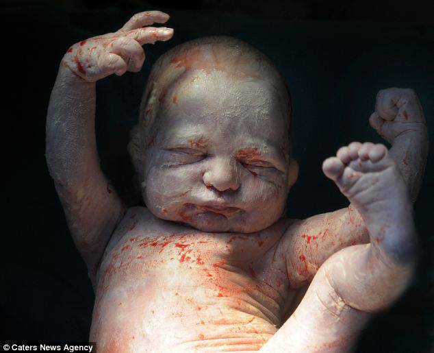 neonato ricoperto sangue