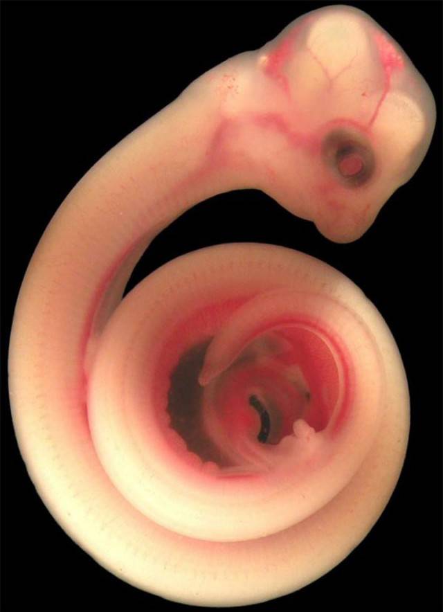 serpente in utero