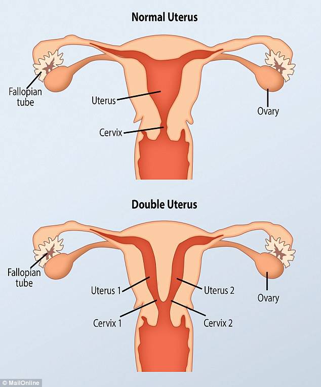 utero donna
