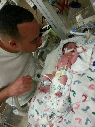 neonata intubata col papà