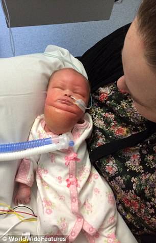 neonata malata in ospedale