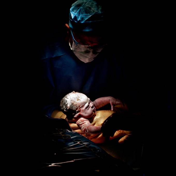 neonato tra braccia medici