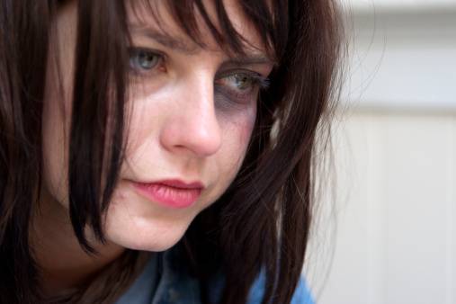 Young woman with black-eye crying