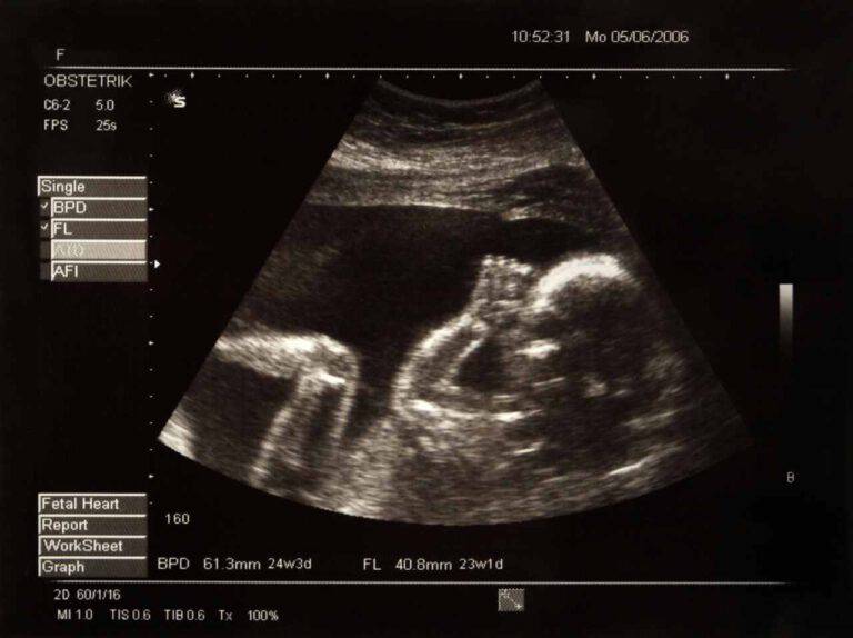 Futuro papà non vedente riceve un regalo: un'ecografia speciale del figlio